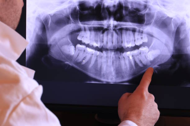 Best Emergency Tooth Extraction in Woodcrest, CA