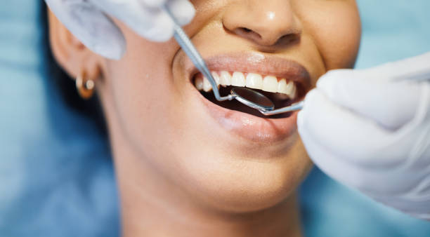 Best Emergency Wisdom Teeth Removal in Woodcrest, CA
